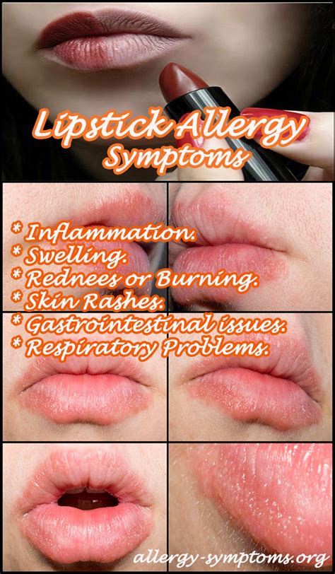 lipstick allergy